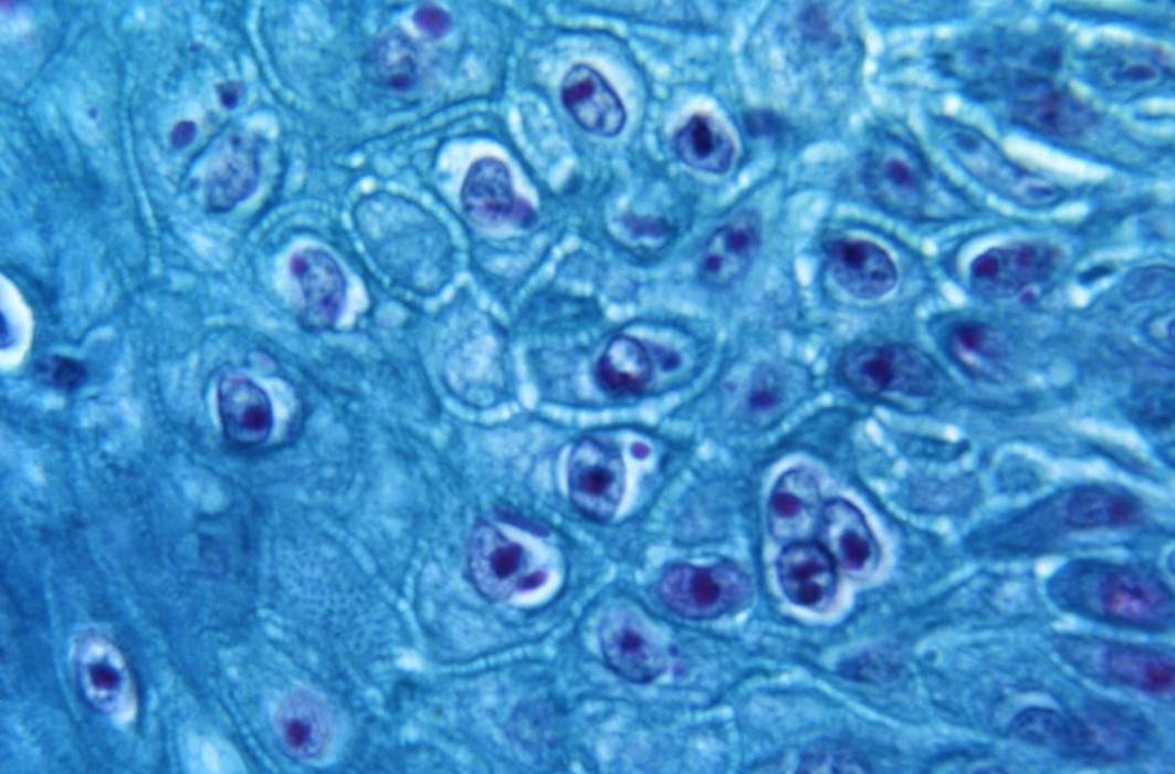 Microscopic View of Monkeypox Virus.